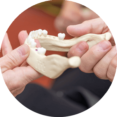 jaw bone model being held