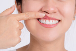 Woman showing her upper gums with her finger, an expression of pain. Dental care and toothache.