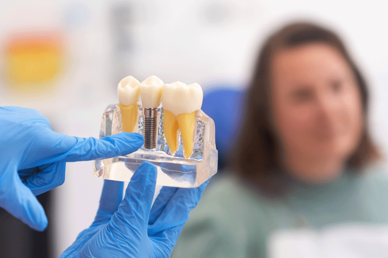 Close-up of dental model with implant. patient of dental clinic on blurred background. dentistry.